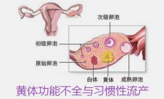 习惯性流产有哪些症状？